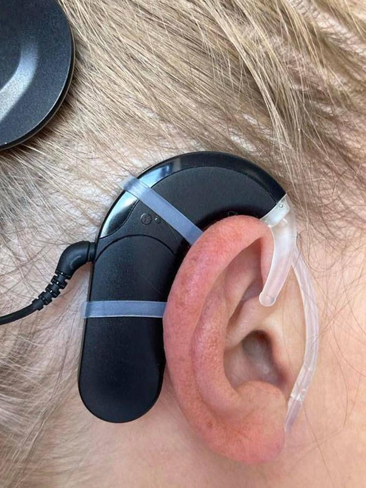 Koszty eksploatacji aparatów słuchowych