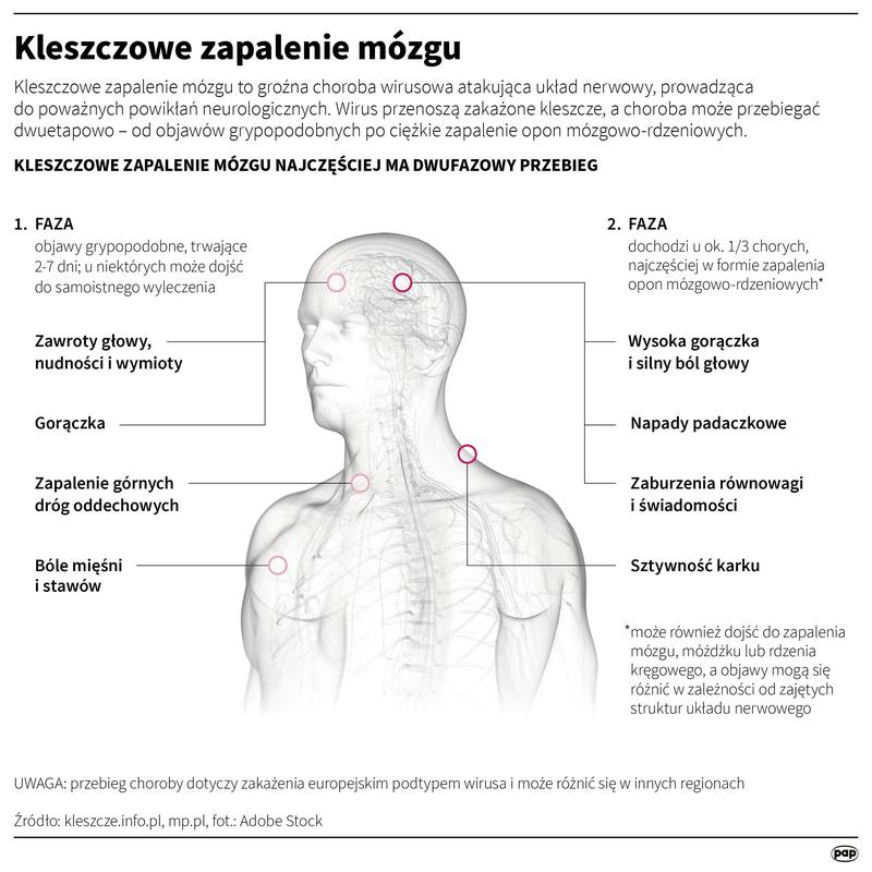 Objawy zapalenia opon mózgowych